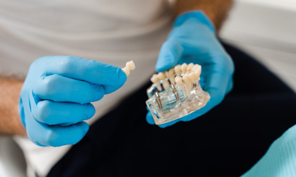 Close-up of a dental implant model showing implant placement in the jaw